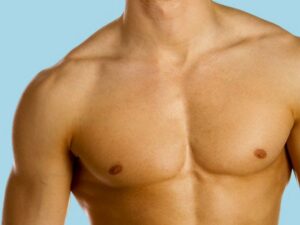 Pectoral Implants