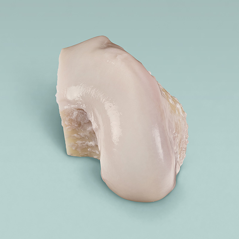 Osteochondral Allografts