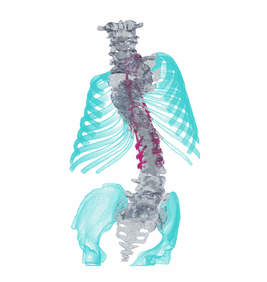 AccuModel