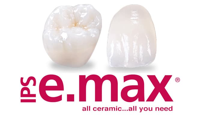 Full Dentures