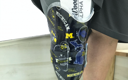 Prosthetics