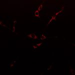 Mitochondrial Probe