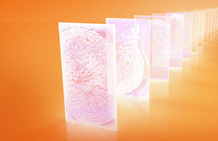 Illumina StrataMap Spatial