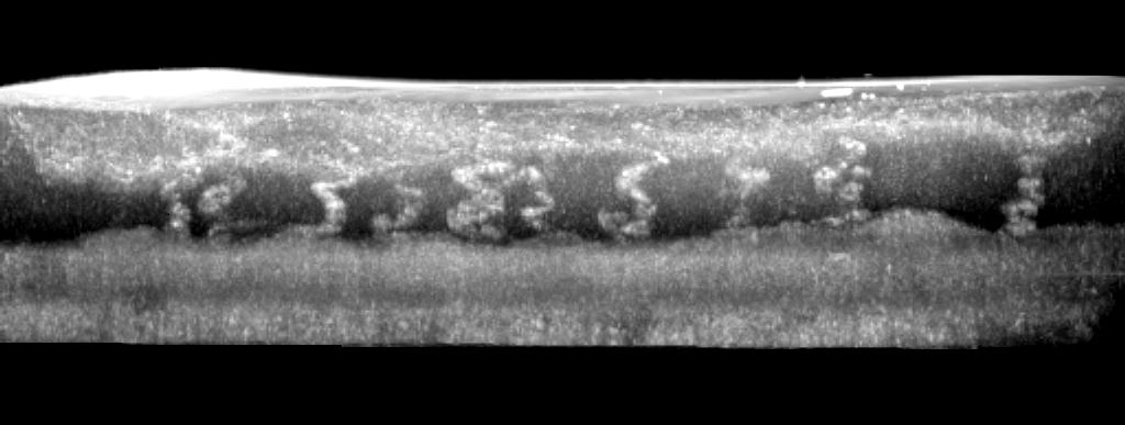 Optical Biopsy