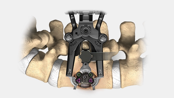 Retractor