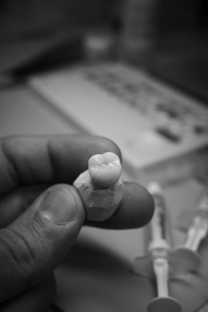 Molar crown macro detail