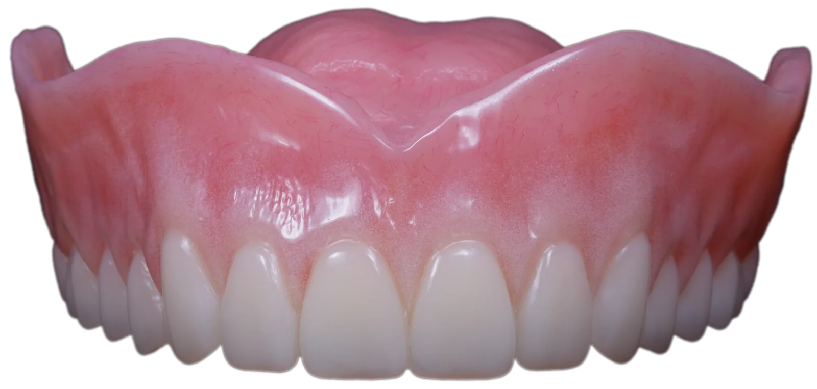 Upper denture removable prosthetic
