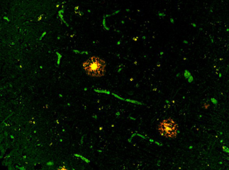 Fluorescent Beta-Amyloid Probes