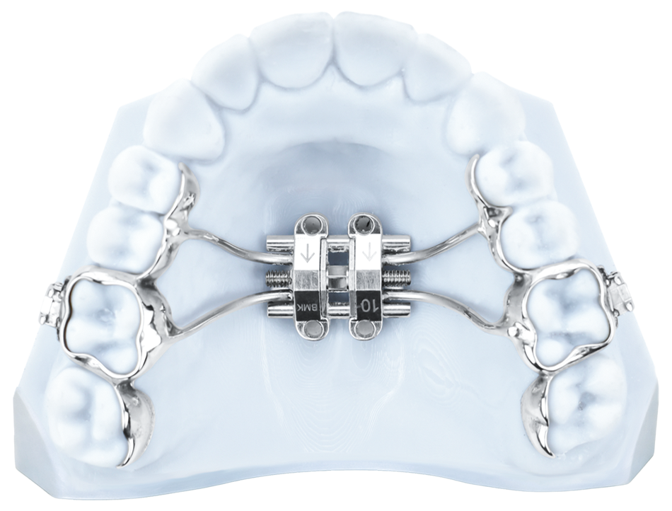 MSE MARPE Expander
