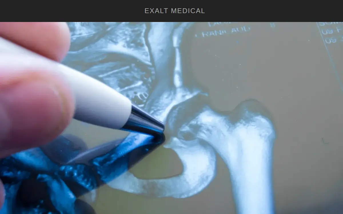 Homepage of Exalt Devices, LLC