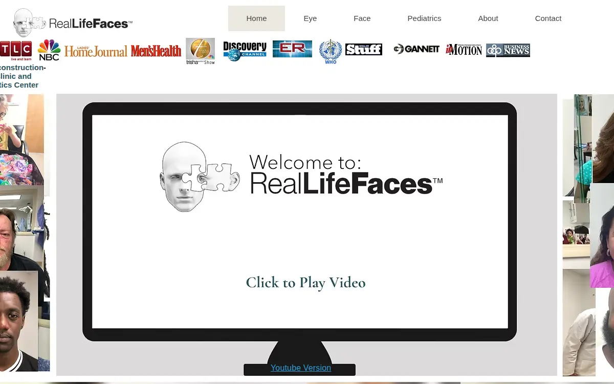Homepage of Alloplastic Reconstruction INC